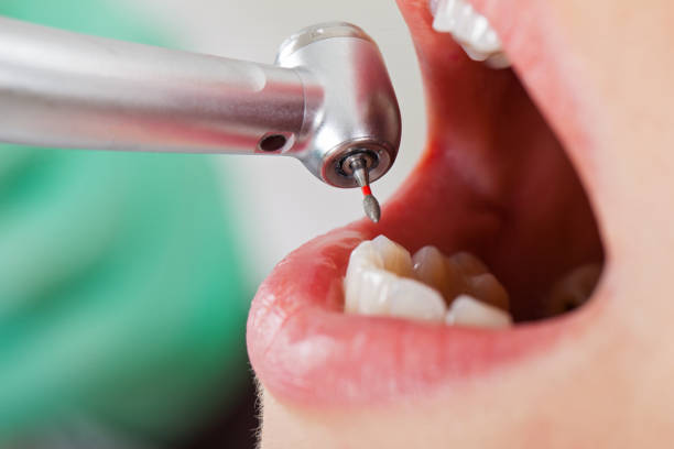 Best Emergency Tooth Extraction in Oak Ridge, NJ